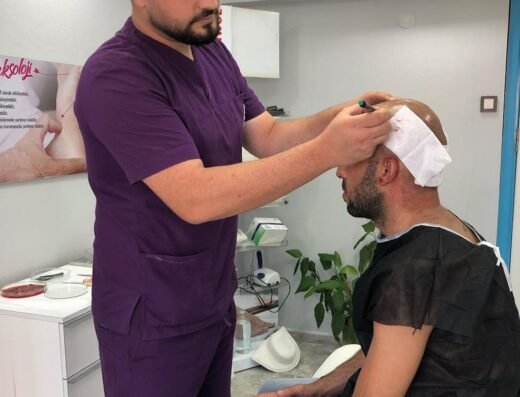 Hair Transplant Of Antalya / Antalya Saç Ekimi / Altınsoy Hair Clinic